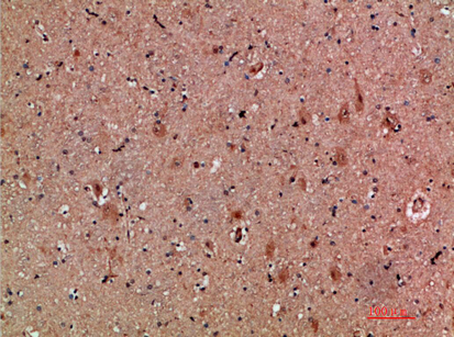 a08886 clcf1 primary antibodies ihc testing 1