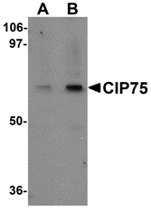 Western blot analysis of CIP75 in 3T3 cell lysate with CIP75 antibody at (A) 1 and (B) 2 μg/mL