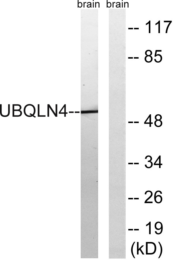 Western blot analysis of lysates from mouse brain, using UBQLN4 Antibody