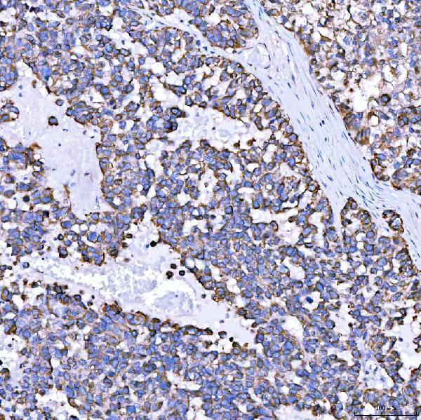  IHC analysis of SUMF2 using anti-SUMF2 antibody (A08890)