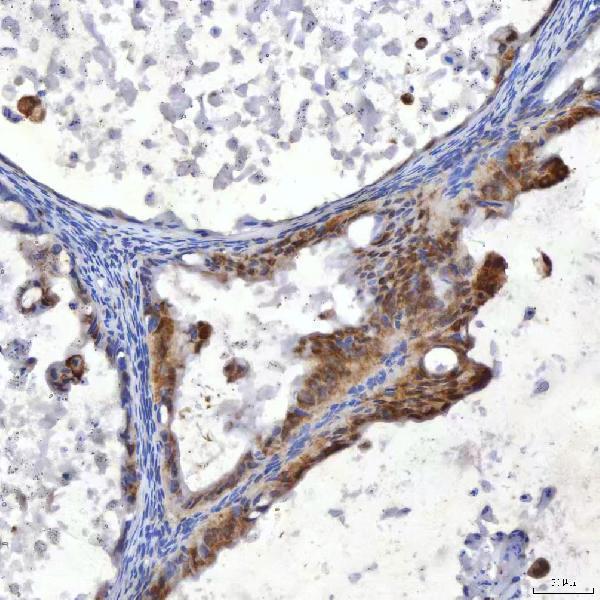 a08890 sumf2 primary antibodies ihc testing 4