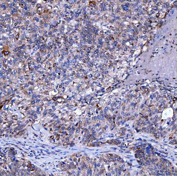a08890 sumf2 primary antibodies ihc testing 6