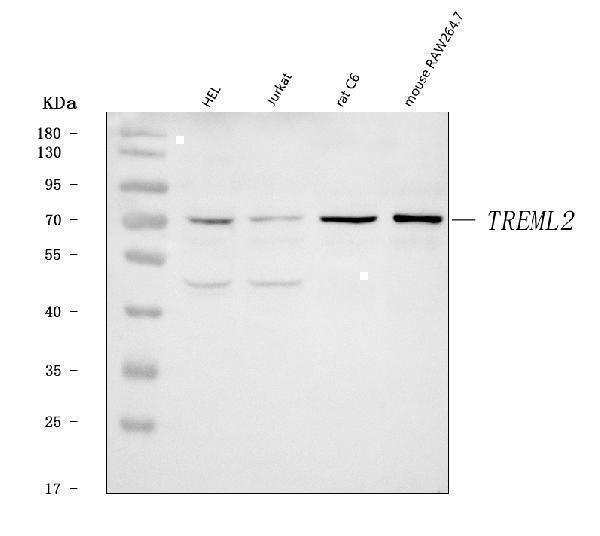  Western blot analysis of TREML2 using anti-TREML2 antibody (A08894-1)