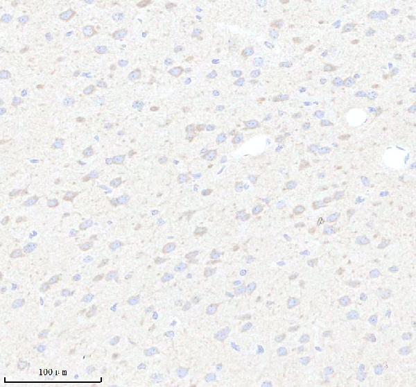 IHC analysis of HS3ST2 using anti-HS3ST2 antibody (A08897-1)
