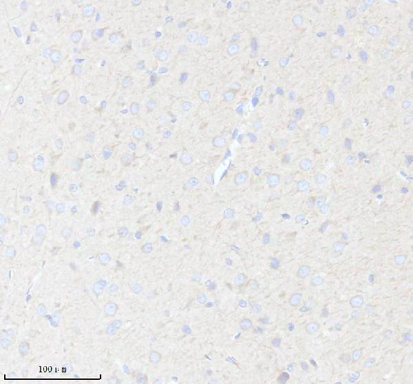 IHC analysis of HS3ST2 using anti-HS3ST2 antibody (A08897-1)