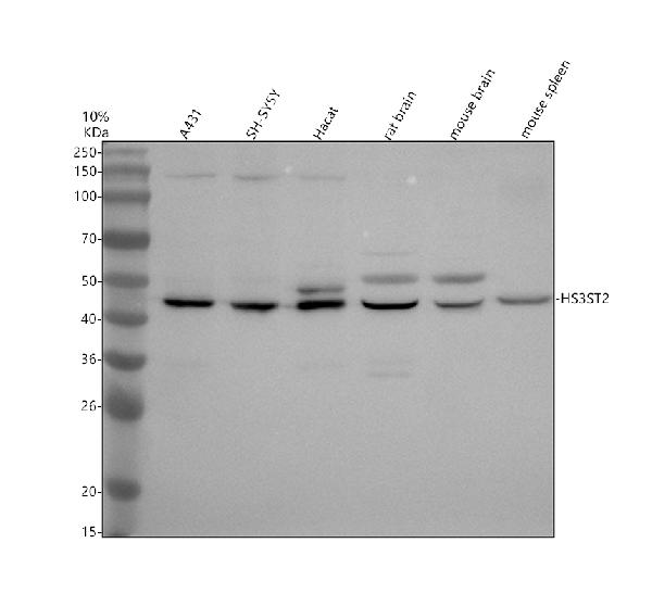 Western blot analysis of HS3ST2 using anti-HS3ST2 antibody (A08897-1)