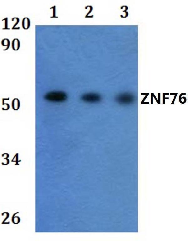 a08898 1 znf76 primary antiboties wb testing 1