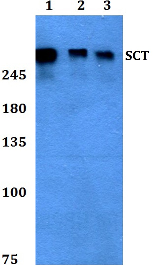 Western blot (WB) analysis of SCT polyclonal antibody at 1:500 dilution
Lane1:HEK293T whole cell lysate
Lane2:Raw264