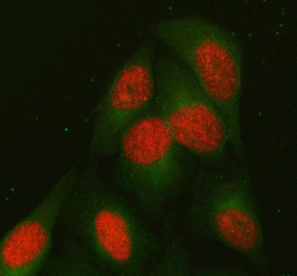 IF analysis of PAPSS1 using anti-PAPSS1 antibody (A08903-1) and anti-Alpha Tubulin antibody (M03989-3)
