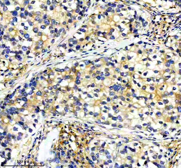 a08904 dock3 primary antibodies ihc testing 2