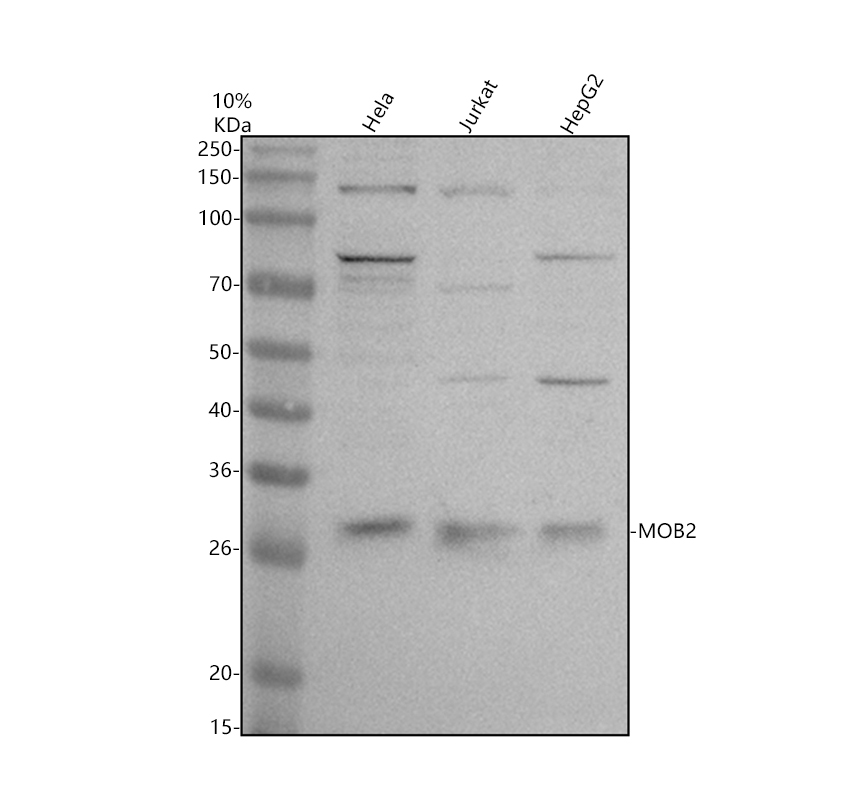 Western blot analysis of MOB2 using anti-MOB2 antibody (A08906-2)
