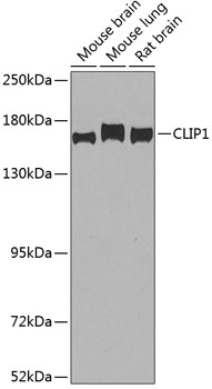 a08907 1 clip1 primary antiboties wb testing 1