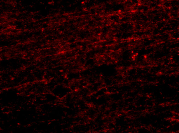 a08907 clip1 primary antibodies if testing 2