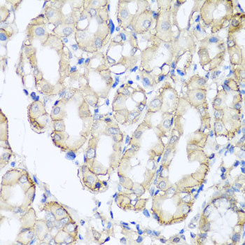 a08908 1 ahcyl1 primary antiboties ihc testing 2