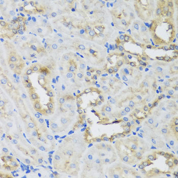 a08908 1 ahcyl1 primary antiboties ihc testing 3