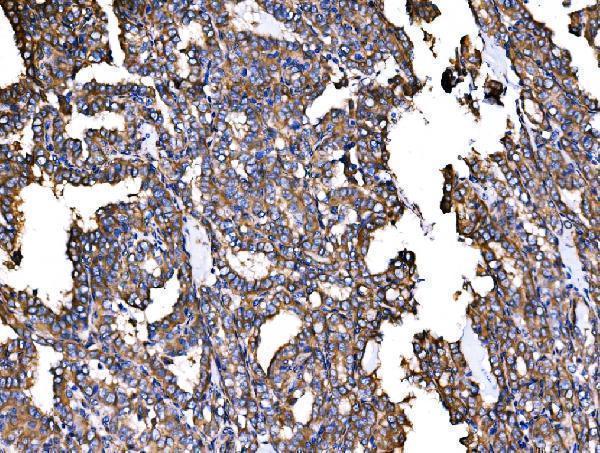  IHC analysis of IRBIT/AHCYL1 using anti-IRBIT/AHCYL1 antibody (A08908-2)