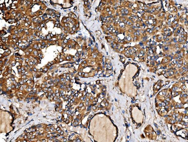 a08908 2 ahcyl1 primary antibodies ihc testing 4
