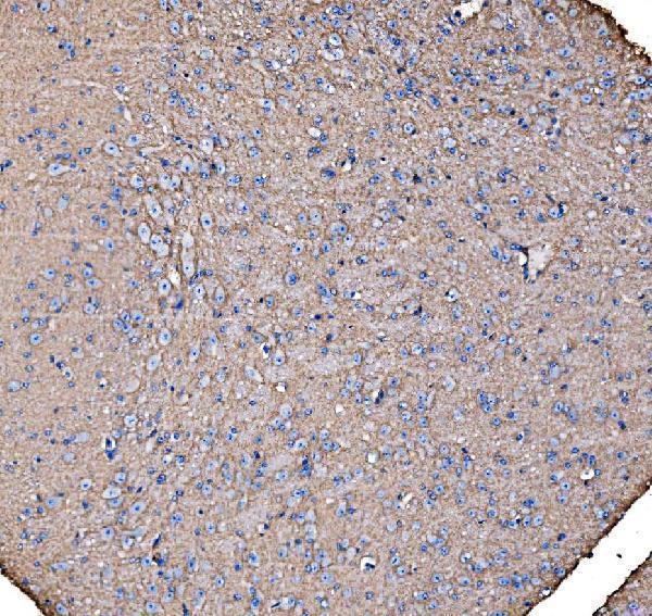 a08908 2 ahcyl1 primary antibodies ihc testing 6
