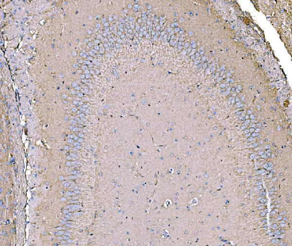 a08908 2 ahcyl1 primary antibodies ihc testing 7