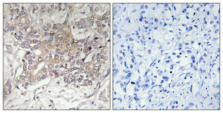 a08909 1 gcnt3 primary antibodyes ihc testing 1