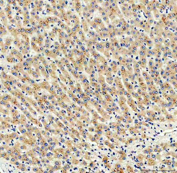  IHC analysis of VILIP3/HPCAL1 using anti-VILIP3/HPCAL1 antibody (A08911-1)