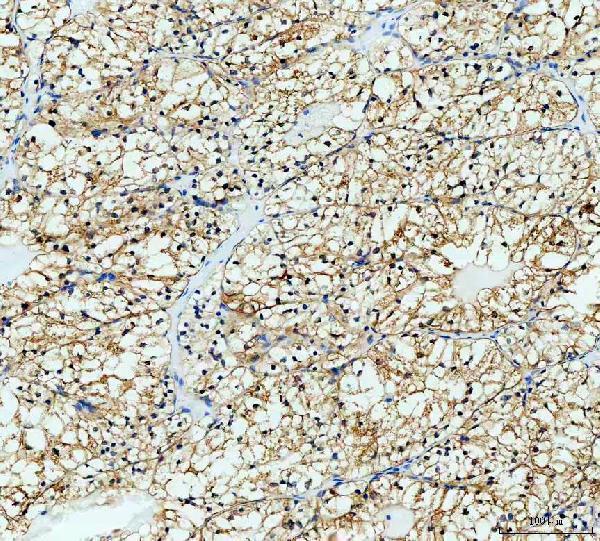  IHC analysis of VILIP3/HPCAL1 using anti-VILIP3/HPCAL1 antibody (A08911-1)