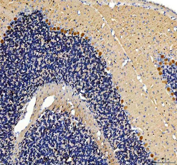a08911 1 vilip3 hpcal1 primary antibodies ihc testing 4
