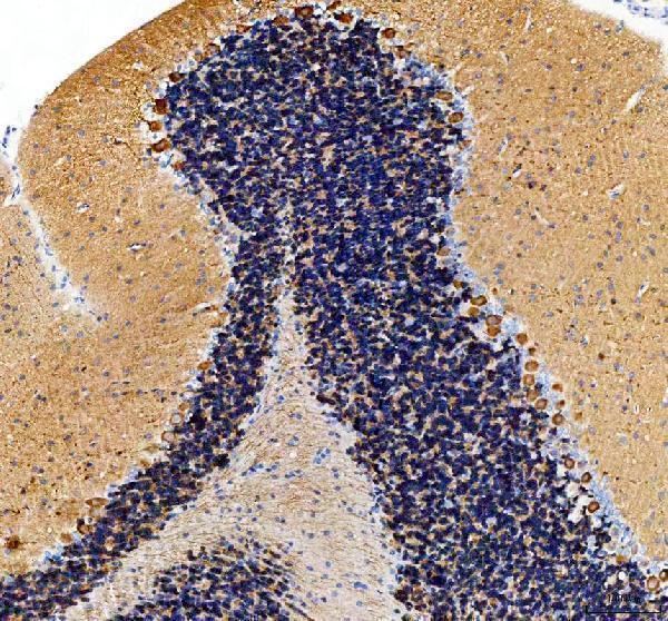 a08911 1 vilip3 hpcal1 primary antibodies ihc testing 5