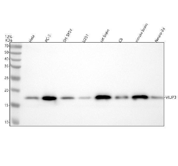 Western blot analysis of VILIP3/HPCAL1 using anti-VILIP3/HPCAL1 antibody (A08911-1)