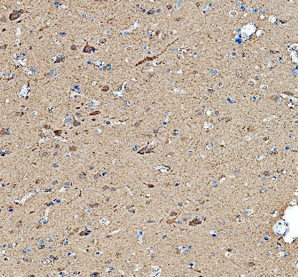 a08912 1 fbxo2 primary antibodies ihc testing 1
