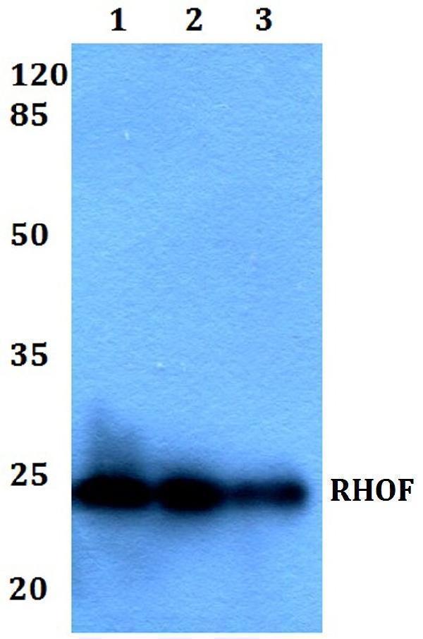 Western blot (WB) analysis of RHOF polyclonal antibody at 1:500 dilution
Lane1:HEK293T whole cell lysate
Lane2:Raw264