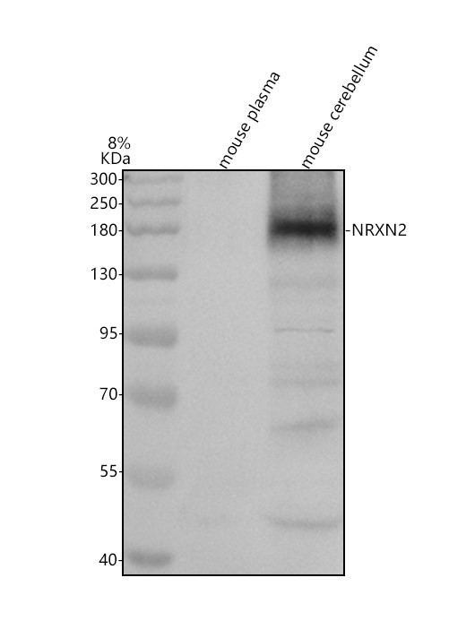 Western blot analysis of NRXN2 using anti-NRXN2 antibody (A08915)