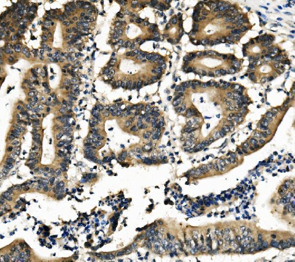  IHC analysis of DNAJA2 using anti-DNAJA2 antibody (A08918-1)