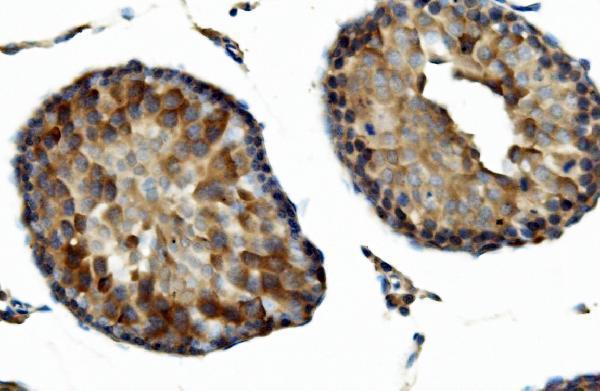 a08918 1 dnaja2 primary antibodies ihc testing 4