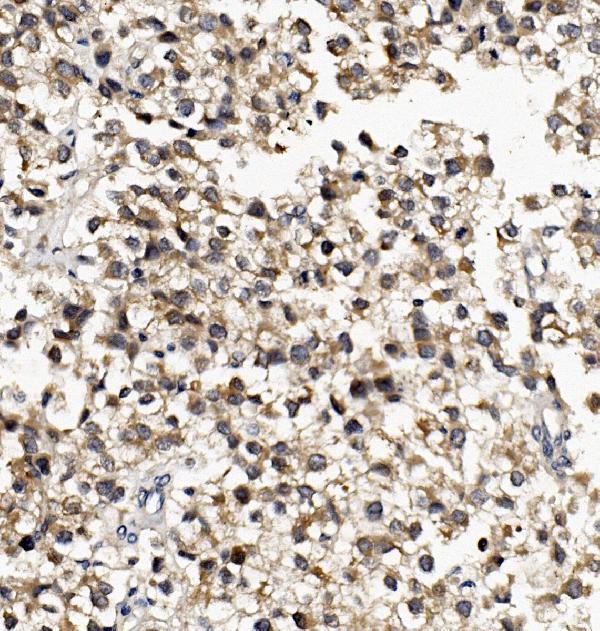 a08918 1 dnaja2 primary antibodies ihc testing 5