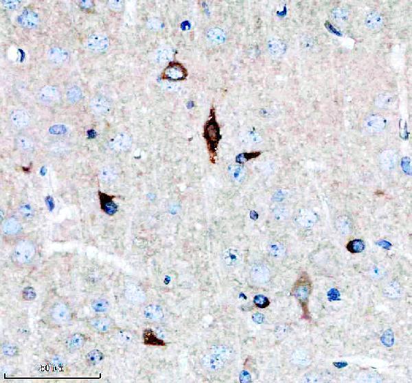 a08919 1 eml1 primary antibodies ihc testing 1