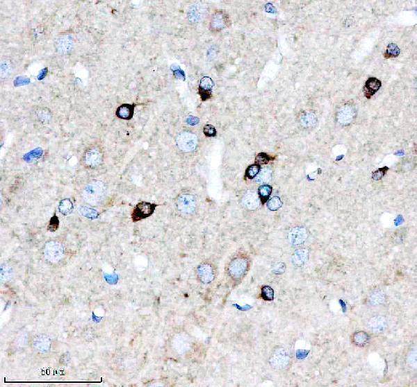 a08919 1 eml1 primary antibodies ihc testing 2