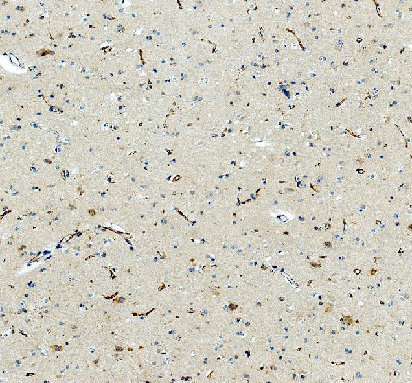 a08919 1 eml1 primary antibodies ihc testing 3