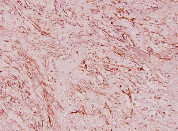 a08922 2 rpl36 primary antiboties ihc testing 2
