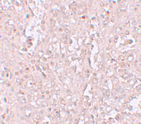 Immunohistochemistry of ZIP13 in human spleen tissue with ZIP13 antibody at 2