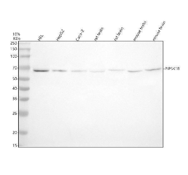  Western blot analysis of PIP5K1B using anti-PIP5K1B antibody (A08932-1)