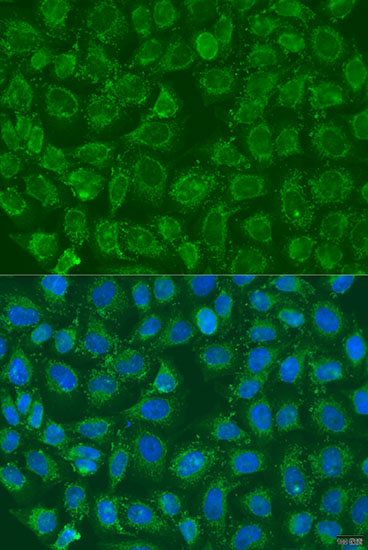 Immunofluorescence analysis of U2OS cells using PIP5K1B antibody  at dilution of 1:100