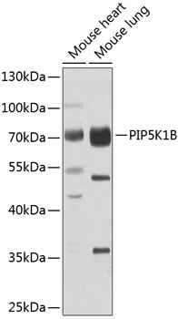 Western blot analysis of extracts of various cell lines, using PIP5K1B antibody  at 1:1000 dilution