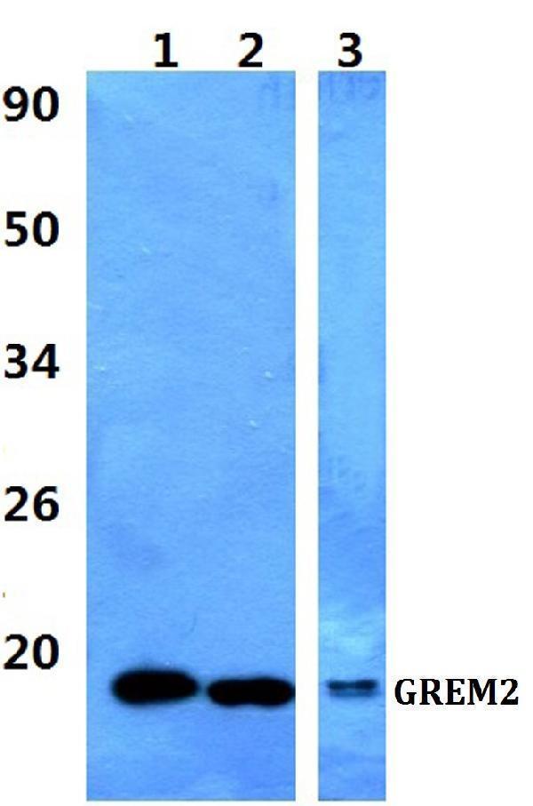 a08939 1 grem2 primary antiboties wb testing 1