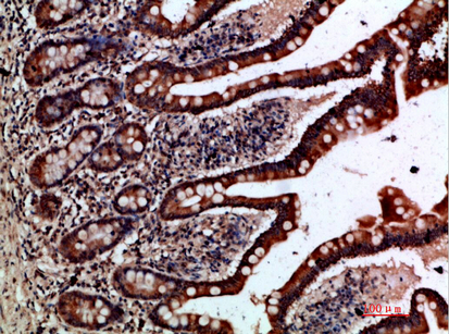 a08939 grem2 primary antibodies if testing 3