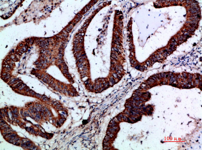 a08939 grem2 primary antibodies ihc testing 1