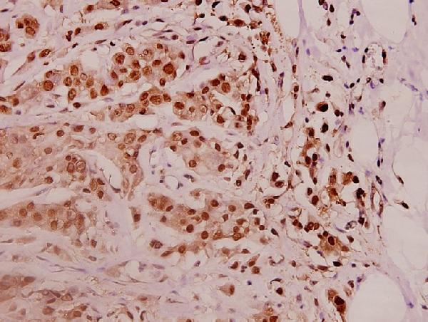 a08940 psmd11 primary antiboties ihc testing 2