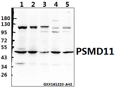 a08940 psmd11 primary antiboties wb testing 1
