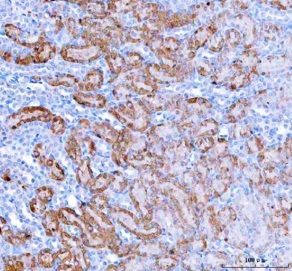 a08943 1 hagh primary antibodies ihc testing 10