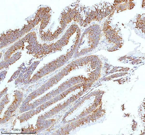 a08943 1 hagh primary antibodies ihc testing 4